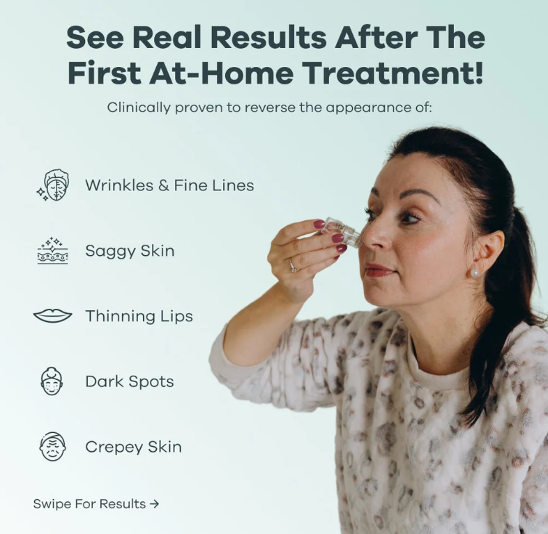 Micro-needle Peptide Serum