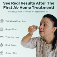 Micro-needle Peptide Serum