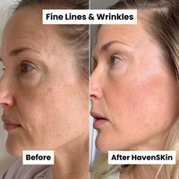 Micro-needle Peptide Serum