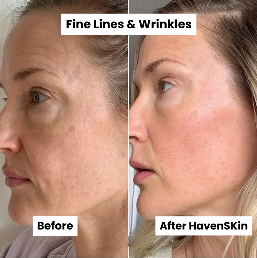 Micro-needle Peptide Serum